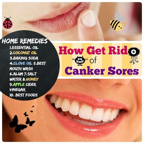 How to get rid of canker sores: 1.Essential oil 2.Coconut OIl 3.Baking ...