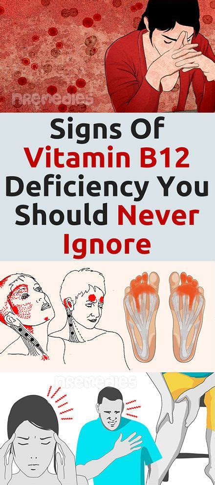 Signs-Of-Vitamin-B12-Deficiency-You-Should-Never-Ignore.jpg | Vitamin ...