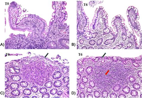 Ascending Colon Histology