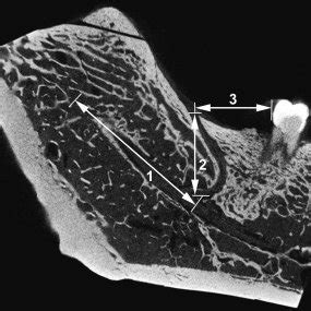 Histology of the retromolar canal. A = artery with a thick wall ...