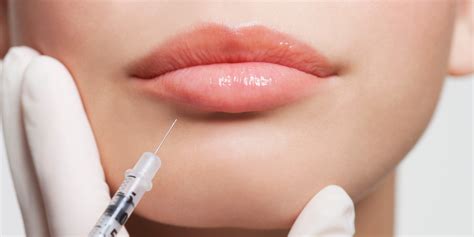 Facial Fillers and Injections Are the Biggest Trends in Plastic Surgery ...