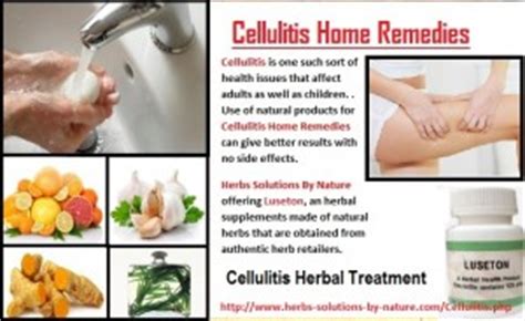 6 Effective Cellulitis Home Remedies - Herbs Solutions By Nature