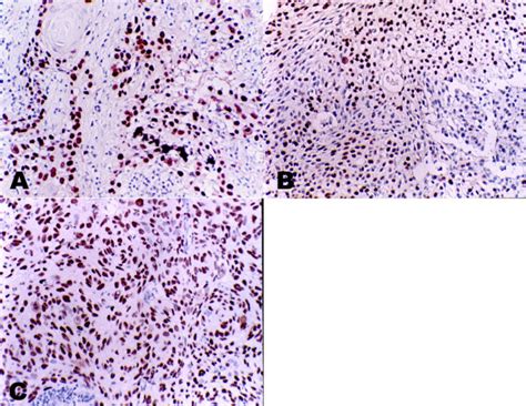 Immunohistochemical demonstration of p63 protein expression in ...