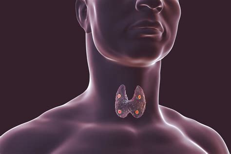 Parathyroid Glands | Kent ENT Partnership