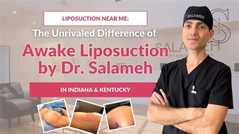 Liposuction Near Me: Awake Liposuction in Indiana & Kentucky