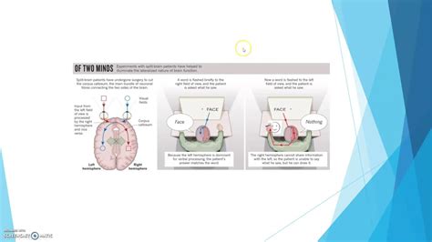 🎉 Split brain patients. Split Brain Patients. 2019-02-22