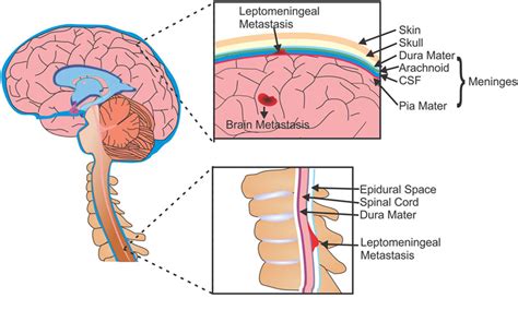 Frontiers | Preclinical Modeling and Therapeutic Avenues for Cancer Metastasis to the Central ...