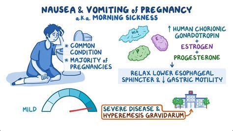 Nausea and vomiting of pregnancy: Clinical sciences - Osmosis Video Library