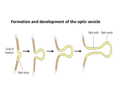 Development Of Eye by Tauqeer Ahmad