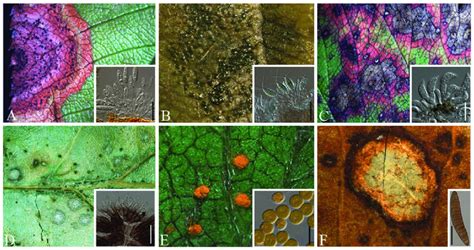 Microscopic images of some foliar diseases and their causative agents ...