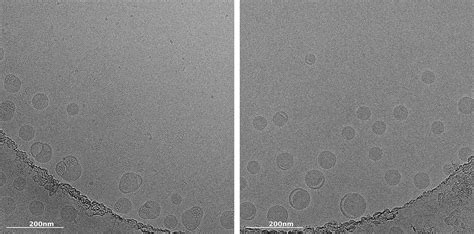 Lipid Nanoparticle characterization with cryo-TEM | Nano Imaging