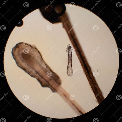 Demodex Folliculorum - Parasitic Mite on the Eyelashes of a Human Eye Stock Photo - Image of ...