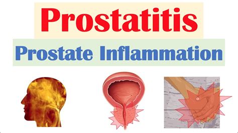 Prostate Inflammation