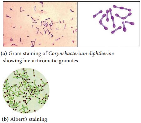 Corynebacterium diphtheriae