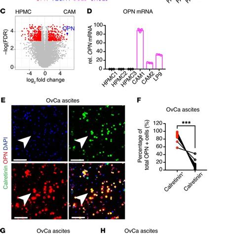 Cancer-associated mesothelial cells promote ovarian cancer stemness ...