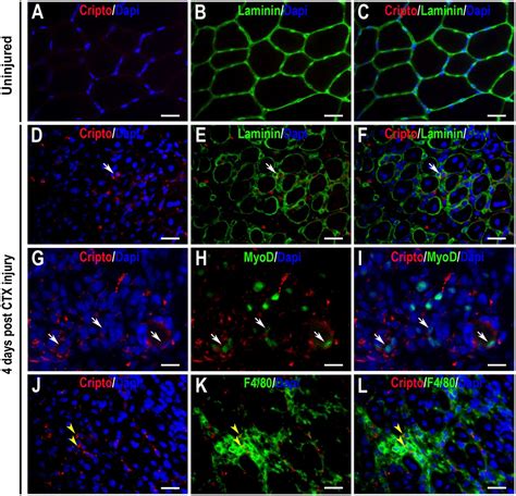 Cripto regulates skeletal muscle regeneration and modulates satellite cell determination by ...