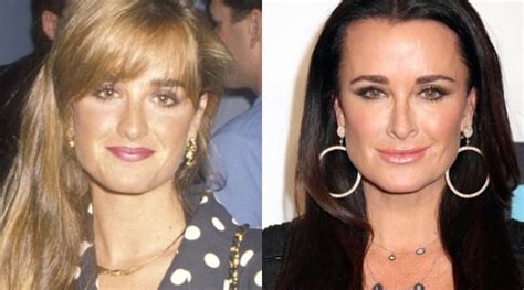 Kyle Richards plastic surgery – did she really needed to change so ...