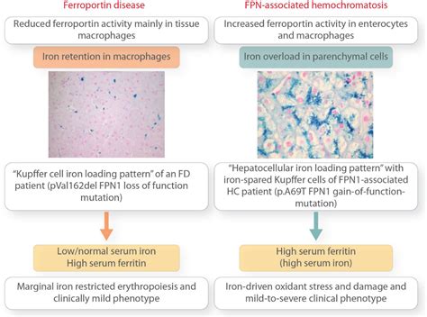 Ferroportin disease: pathogenesis, diagnosis and treatment | Haematologica