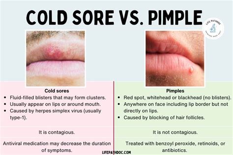 Cold Sore vs. Pimple: Pictures and Differences