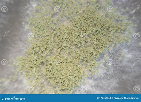 Aspergillus Oryzae is a Filamentous Fungus, or Mold that is Used in ...