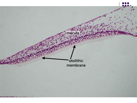 Otolithic Membrane Histology