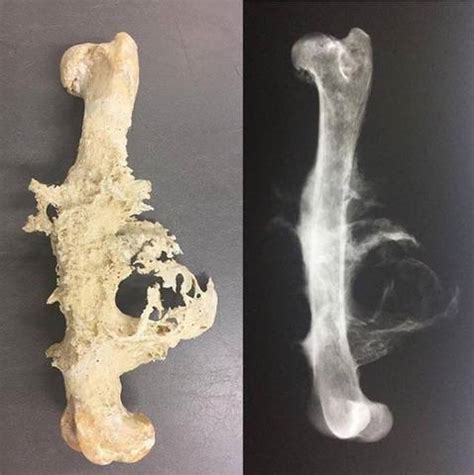 Osteosarcoma : r/Radiology