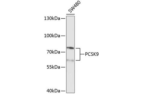 Anti-PCSK9 Antibody (A15935) | Antibodies.com