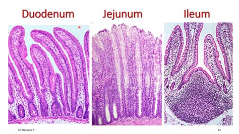 Human Duodenum Histology