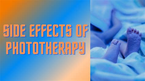 Phototherapy for Newborn Jaundice, Side Effects of Phototherapy - YouTube