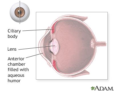 Ciliary body Information | Mount Sinai - New York