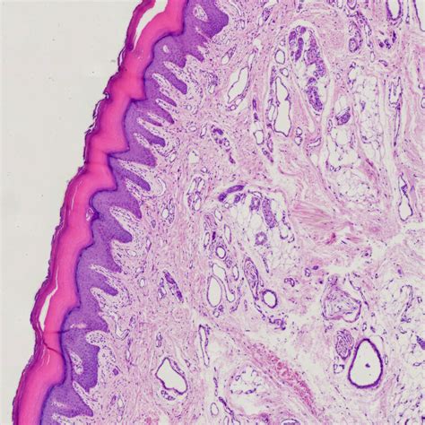 1pcs Tactile corpuscles or Meissner's corpuscles, section of human ...