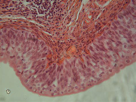 Epithelial Tissue Under Microscope