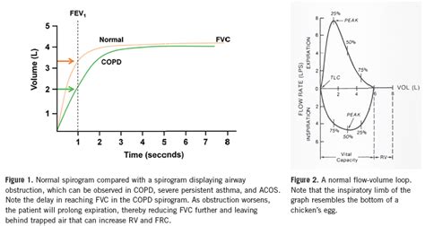 Spirometry: Why, How, and When? | Consultant360