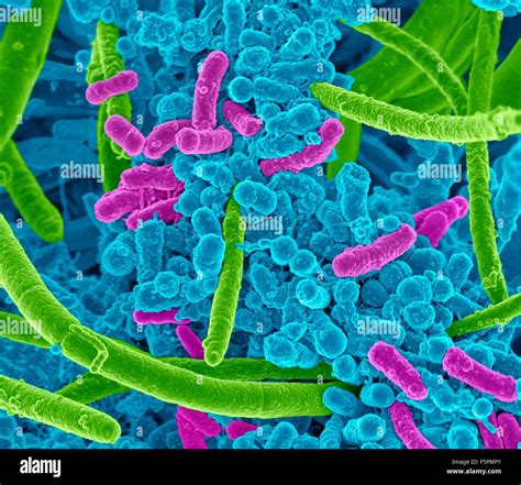 Oral bacteria. Coloured scanning electron micrograph (SEM) of mixed Stock Photo, Royalty Free ...