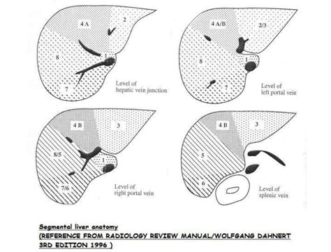 Liver - Anatomy - Segmental liver Anatomy by US | Ultrasound, Radiology ...