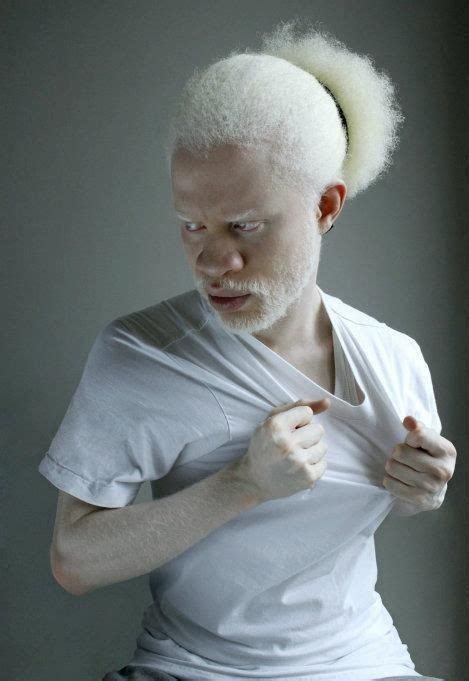 Pin by Hillary Shai on Albinos | Unique faces, Albino men, Albino model