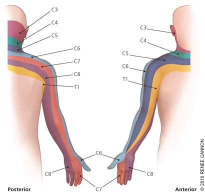 C7 8 nerve root compression