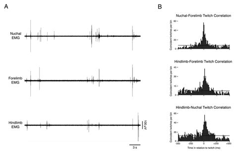 Correlated bouts of myoclonic twitches in multiple muscle groups (A)... | Download Scientific ...