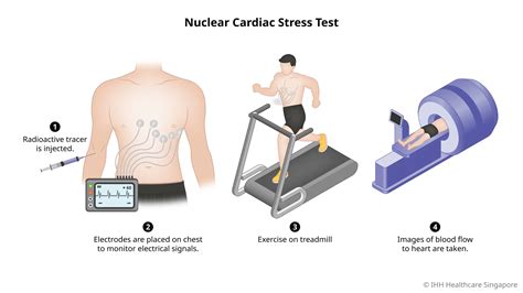 Nuclear Cardiac Stress Test | Parkway East Hospital