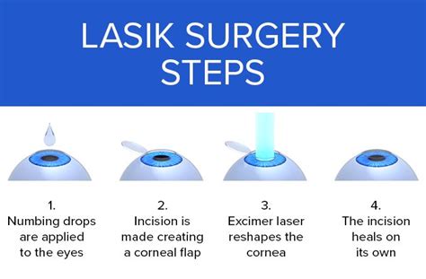 LASIK Enhancement: When Additional Surgery Is Needed