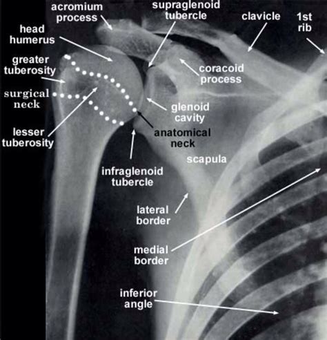 Pin on Anatomy - Imaging