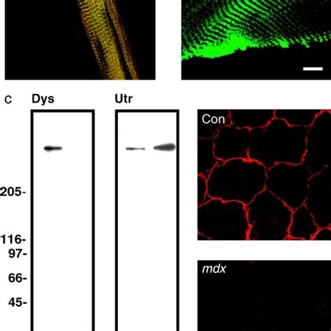 Dystrophin and F-actin colocalize on mechanically isolated sarcolemma... | Download Scientific ...