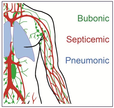 Biomedicines | Free Full-Text | Plague Prevention and Therapy: Perspectives on Current and ...