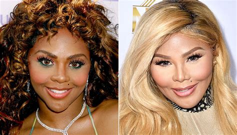 Celebs Who Are Nearly Unrecognizable After Plastic Surgery - Mind Your ...