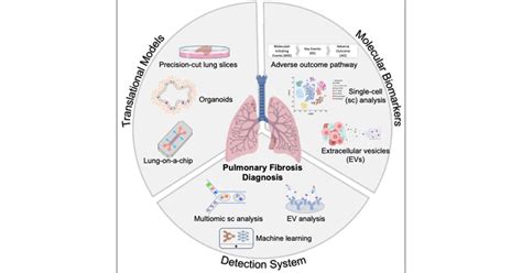 Recent Advances in Molecular Diagnosis of Pulmonary Fibrosis for ...