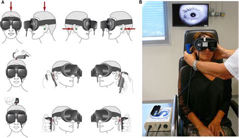 Frontiers The Skull Vibration-Induced Nystagmus Test of Vest - DaftSex HD