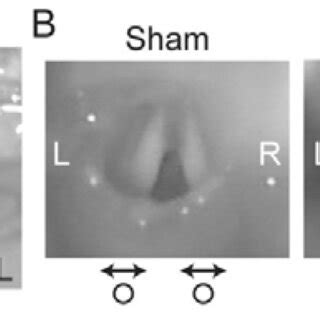 Unilateral vagotomy and swallowing videofluoroscopy. A VN transection... | Download Scientific ...