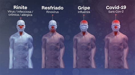 O frio chegou: entenda diferença entre doenças como Covid-19, gripe e ...