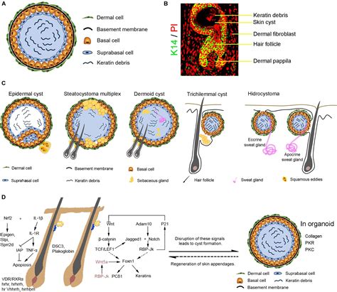 Top 111 + Eruptive vellus hair cysts cause - polarrunningexpeditions