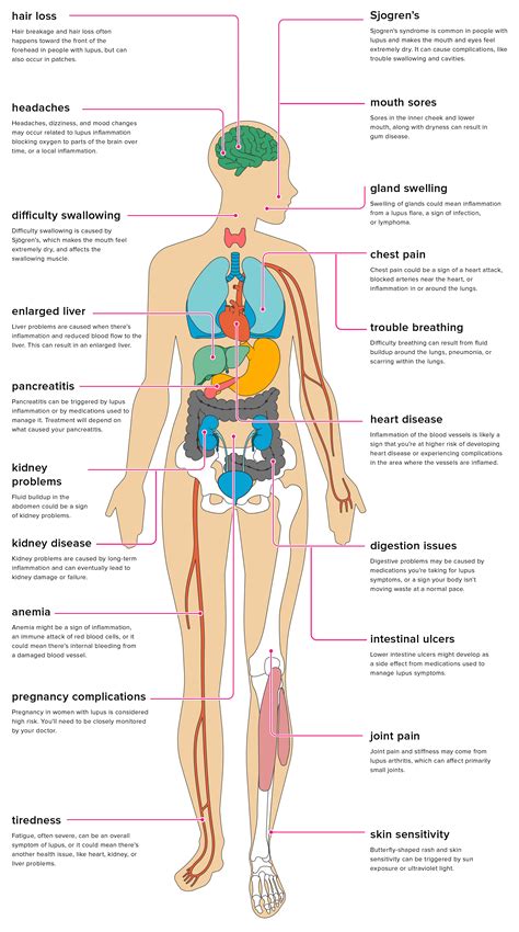 The Effects of Lupus on the Body